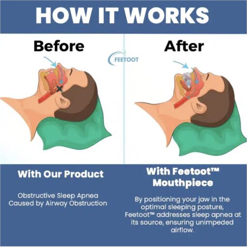 Soothie AirFlow Mouthpiece