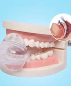 SnoreShield