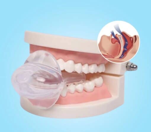 SnoreShield