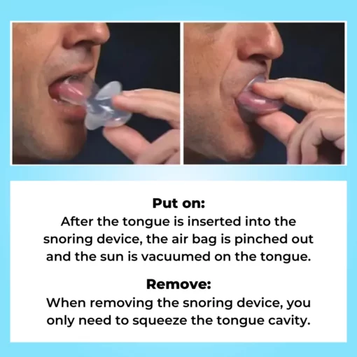 SleepEase Mouthguard